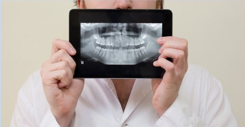 رادیوگرافی پری اپیکال دندان 11 رادیوگرافی پری اپیکال دندان