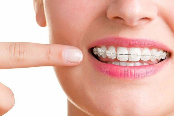 ارتودنسی دندان ارزان ارتودنسی دندان ارزان